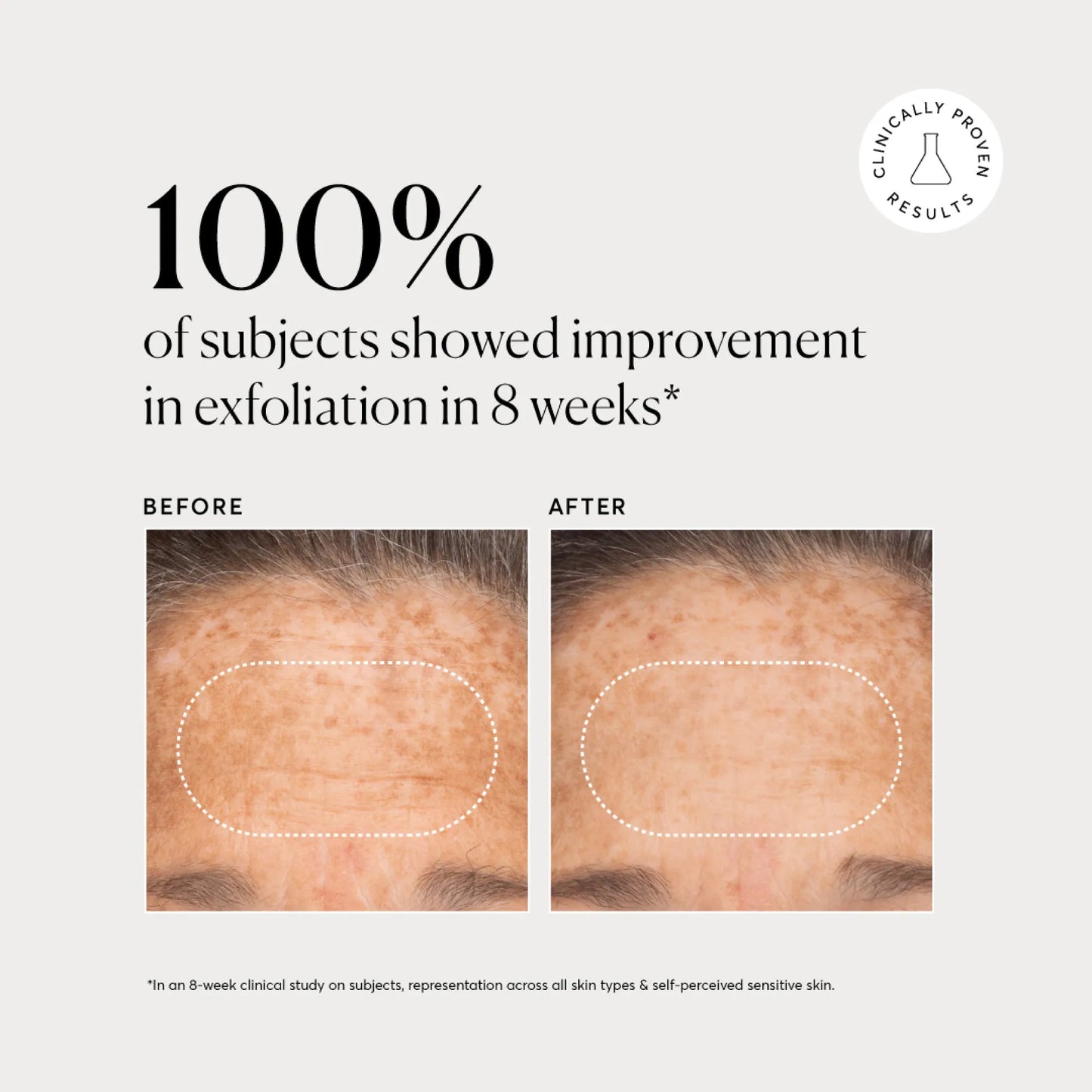 bha-liquid-exfoliant-2-e2 NATR-10027-Alt-Images-BHA-Liquid-Exfoliant-2_-03.webp
