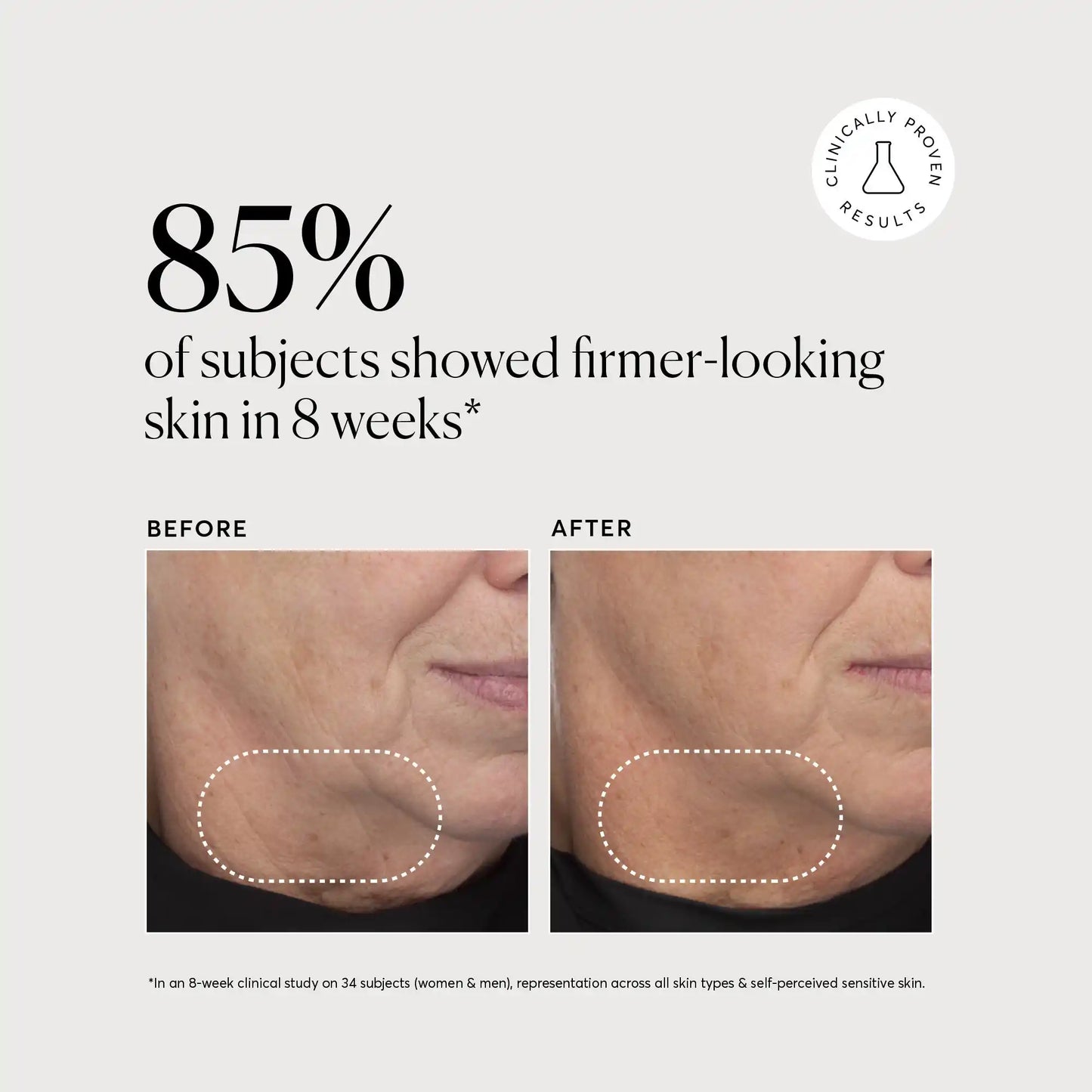 retinol-complex-serum-e1 NATR-10034-Alt-Images-Retinol-Complex-Serum-04.webp